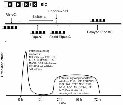 Remote Ischemic Conditioning in Cerebral Diseases and Neurointerventional Procedures: Recent Research Progress